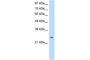 WB Suggested Anti-ZNF575 Antibody Titration:  1.