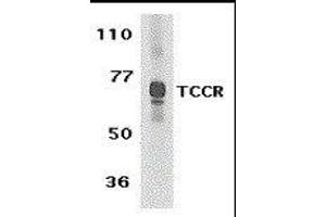 Western Blotting (WB) image for anti-Interleukin 27 Receptor, alpha (IL27RA) (C-Term) antibody (ABIN2474995)