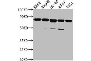 Western Blot Positive WB detected in: K562 whole cell lysate, HepG2 whole cell lysate, HL-60 whole cell lysate, A549 whole cell lysate, U251 whole cell lysate All lanes: TMEM214 antibody at 1:2000 Secondary Goat polyclonal to rabbit IgG at 1/50000 dilution Predicted band size: 78, 73 kDa Observed band size: 78 kDa (TMEM214 Antikörper  (AA 2-236))