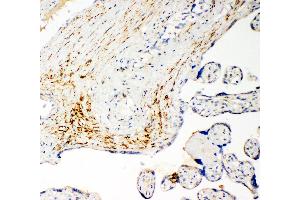 Anti-SLC16A4 antibody, IHC(P) IHC(P): Human Placenta Cancer Tissue (SLC16A4 Antikörper  (N-Term))