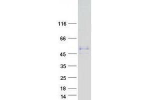 Validation with Western Blot (WTIP Protein (Myc-DYKDDDDK Tag))