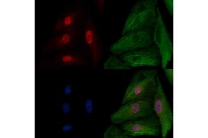 ABIN6257153 and ABIN6274164 staining  cells by IF/ICC.