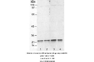 Image no. 2 for anti-Caveolin 1, Caveolae Protein, 22kDa (CAV1) antibody (ABIN363230) (Caveolin-1 Antikörper)