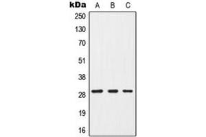 Western blot analysis of G18 expression in MCF7 (A), mouse brain (B), PC12 (C) whole cell lysates. (GPSM3 Antikörper  (Center))