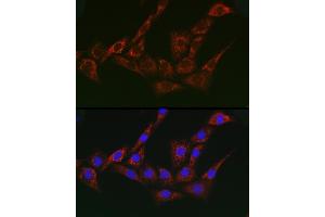 Immunofluorescence analysis of NIH/3T3 cells using G1 Rabbit pAb (ABIN7265447) at dilution of 1:200 (40x lens). (gamma 1 Adaptin Antikörper  (AA 1-240))
