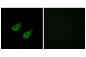Immunofluorescence analysis of HeLa cells, using JIP3 antibody. (JIP3 Antikörper  (Internal Region))