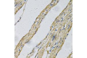 Immunohistochemistry of paraffin-embedded human smooth muscle using PRNP Antibody (ABIN5971407) at dilution of 1/100 (40x lens). (PRNP Antikörper)