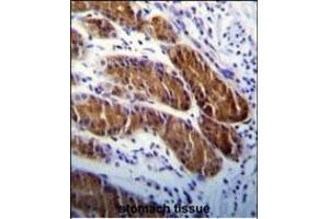ATG5 Antibody (ABIN650657 and ABIN2849633) immunohistochemistry analysis in formalin fixed and paraffin embedded human stomach tissue followed by peroxidase conjugation of the secondary antibody and DAB staining. (ATG5 Antikörper)