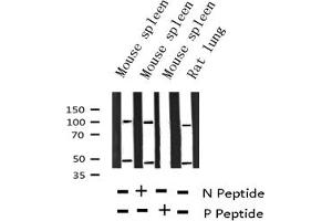Western Blotting (WB) image for anti-Nuclear Factor of kappa Light Polypeptide Gene Enhancer in B-Cells 1 (NFKB1) (pSer337) antibody (ABIN6256276)