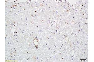Formalin-fixed and paraffin embedded rat brain tissue  at 1:300 followed by conjugation to the secondary antibody and DAB staining.