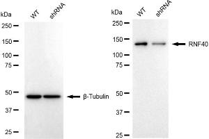 Western blotting analysis using RNF40 antibody (ABIN7800634).