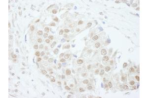 anti-Pseudouridylate Synthase 1 (PUS1) (AA 377-427) antibody