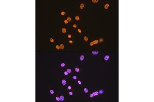 Immunofluorescence (IF) image for anti-TAR DNA Binding Protein (TARDBP) antibody (ABIN7270730)