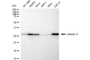 Western blotting analysis using Galectin 3 antibody (ABIN7798688).