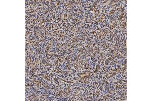 IHC analysis of SLC25A24 using anti-SLC25A24 antibody (ABIN7599228).