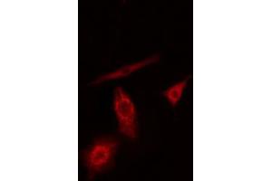 ABIN6274186 staining A549 cells by IF/ICC. (PFKL Antikörper  (C-Term))