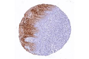 anti-Plasminogen Activator Inhibitor 2 (SERPINB2) antibody