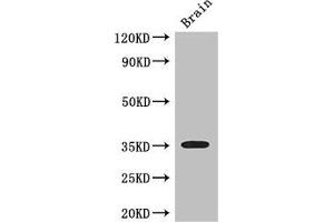 Western Blot Positive WB detected in: Mouse brain tissue All lanes: SFRP1 antibody at 3 μg/mL Secondary Goat polyclonal to rabbit IgG at 1/50000 dilution Predicted band size: 36 kDa Observed band size: 36 kDa (SFRP1 Antikörper  (AA 170-240))