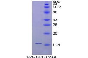 SDS-PAGE analysis of Chicken FABP1 Protein. (FABP1 Protein)