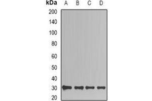 Western blot analysis of TIM expression in Jurkat (A), HepG2 (B), mouse kidney (C), mouse brain (D) whole cell lysates. (TPI1 Antikörper)