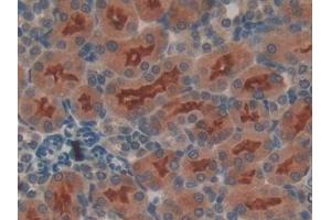 Immunohistochemistry (IHC) image for anti-Fibroblast Growth Factor Receptor-Like 1 (FGFRL1) (AA 164-368) antibody (ABIN7439552)