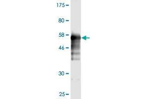 Western Blot detection against Immunogen (55. (Prohibitin Antikörper  (AA 1-272))