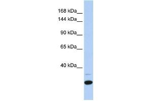 WB Suggested Anti-ZNF197 Antibody Titration:  0. (ZNF197 Antikörper  (N-Term))