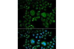 Immunofluorescence analysis of HeLa cells using CA2 Polyclonal Antibody (CA2 Antikörper)