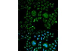 Immunofluorescence analysis of HeLa cells using CA2 Polyclonal Antibody