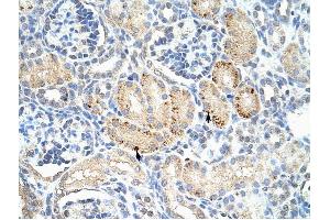FZD7 antibody was used for immunohistochemistry at a concentration of 4-8 ug/ml to stain Epithelial cells of renal tubule (arrows) in Human Kidney. (FZD7 Antikörper)