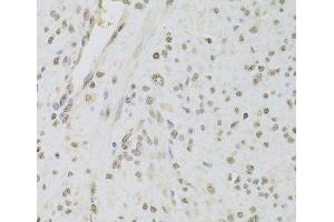 Immunohistochemistry of paraffin-embedded Human leiomyoma of uterus using RUVBL1 Polyclonal Antibody at dilution of 1:100 (40x lens). (RUVBL1 Antikörper)