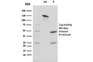 SDS-PAGE Analysis of Purified Cytokeratin 13 Mouse Monoclonal Antibody (KRT13/2213).