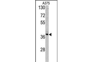 Western blot analysis of TALDO1 antibody (Center) (ABIN390629 and ABIN2840933) in  cell line lysates (35 μg/lane). (TALDO1 Antikörper  (AA 186-215))