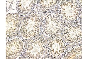 ABIN7095844 and ABIN7099906 at 1/100 staining rat testis tissue by IHC-P. (B4GALNT3 Antikörper)