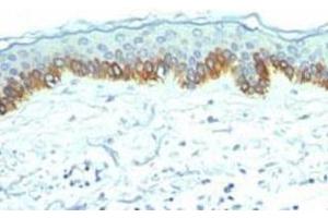 Immunohistochemical staining (Formalin-fixed paraffin-embedded sections) analysis of human skin with Cytokeratin, LMW monoclonal antibody, clone AE1  at 1:200 using peroxidase-conjugate and DAB chromogen. (Cytokeratin 1 Antikörper)