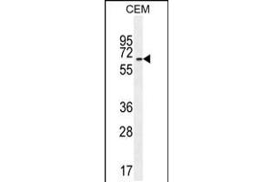 Western blot analysis in CEM cell line lysates (35ug/lane). (UNCX Antikörper  (C-Term))
