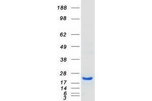 Western Blotting (WB) image for Heat Shock 27kDa Protein Family, Member 7 (Cardiovascular) (HSPB7) protein (Myc-DYKDDDDK Tag) (ABIN2723115)