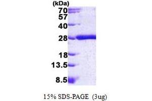 SDS-PAGE (SDS) image for GTPase Kras (KRAS) (AA 1-186) protein (His tag) (ABIN5852938)