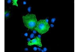 Anti-CCM2 mouse monoclonal antibody (ABIN2454949) immunofluorescent staining of COS7 cells transiently transfected by pCMV6-ENTRY CCM2 (RC201418). (CCM2 Antikörper)