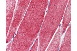 Immunohistochemistry (IHC) image for anti-Solute Carrier Family 36 (Proton/amino Acid Symporter), Member 2 (SLC36A2) (N-Term) antibody (ABIN2781742)
