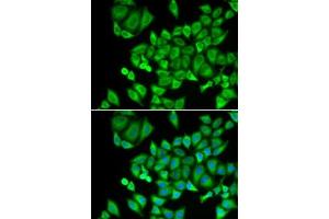 Immunofluorescence analysis of U2OS cells using DHRS9 antibody (ABIN6130324, ABIN6139603, ABIN6139604 and ABIN6221932). (DHRS9 Antikörper  (AA 18-319))