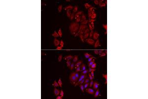 Immunofluorescence analysis of U2OS cells using PAICS antibody. (PAICS Antikörper  (AA 176-425))