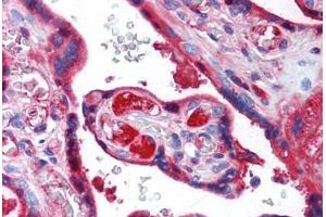 Immunohistochemistry (Paraffin-embedded Sections) (IHC (p)) image for anti-Transferrin (TF) (N-Term) antibody (ABIN462368)
