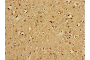Immunohistochemistry (IHC) image for anti-Proteasome Subunit Alpha Type 3 (PSMA3) (AA 218-248) antibody (ABIN7164952)