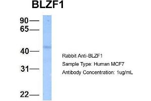 Host: Rabbit Target Name: BLZF1 Sample Type: MCF7 Antibody Dilution: 1. (BLZF1 Antikörper  (N-Term))