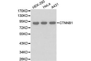 Western blot analysis of extracts of various cell lines, using CTNNB1 antibody. (CTNNB1 Antikörper)