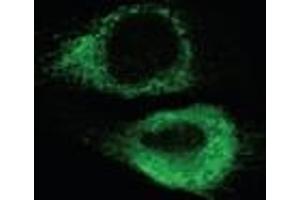 Immunofluorescence analysis of endoplasmic reticulum staining of mouse C2C12 myoblasts transfected with wild type mouse ADAM12 using KDEL (Grp78, Grp94) mAb (10C3). (KDEL Antikörper  (AA 649-654))