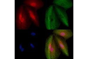 ABIN6259117 and ABIN6273494 staining  cells by IF/ICC. (MORG1 Antikörper  (Internal Region))