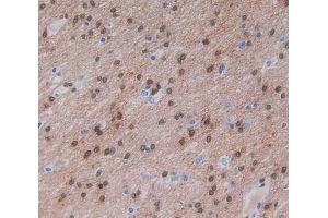 Used in DAB staining on fromalin fixed paraffin- embedded brain tissue (Nischarin Antikörper  (AA 1246-1346))