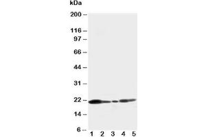 Western blot testing of Caveolin-1 antibody and Lane 1:  U87;  2: HeLa;  3: MCF-7;  4: A549;  5: HT1080 cell lysate